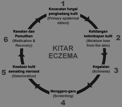 Eczema punca Penyakit Ekzema,